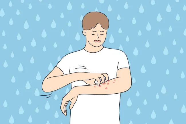 雨后护肤指南：告别高温清爽之余，小心这些“潮湿刺客”！