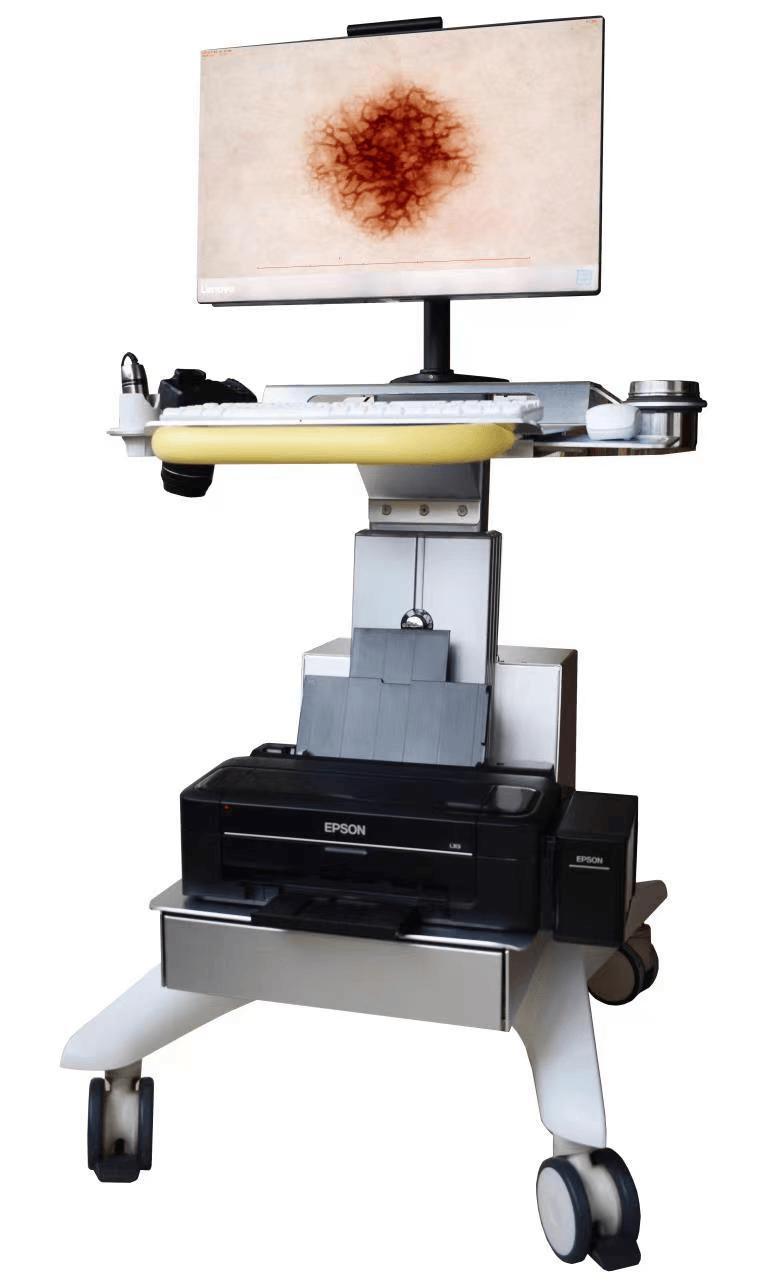 皮肤镜：医生的“透视眼”——揭开皮肤隐藏的秘密